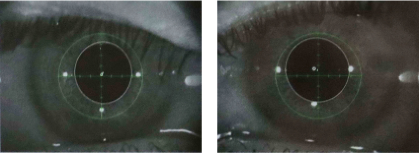 検査中は近赤外線カメラで左右眼の瞳孔を個別にモニター